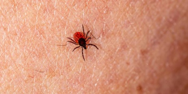 Ministry of Health specialists told what absolutely should not be done if you are bitten by a tick