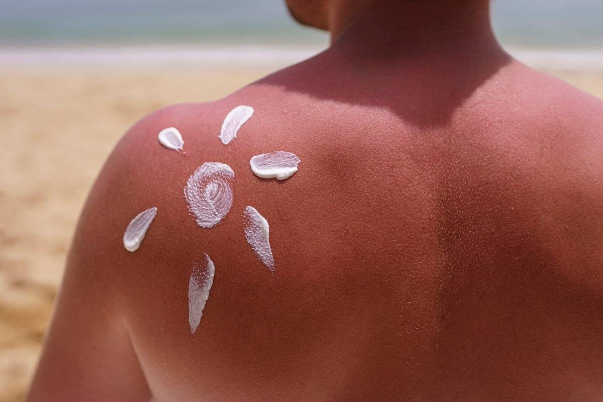 Learn why spring sun can be dangerous, how to recognize and treat sunburns, and how to protect your skin in the first warm days of the season.