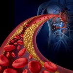 What you need to know about cholesterol in 2025: the effect of food, weight, genetics, and statins on health. Debunking 12 common myths.