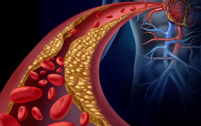 What you need to know about cholesterol in 2025: the effect of food, weight, genetics, and statins on health. Debunking 12 common myths.