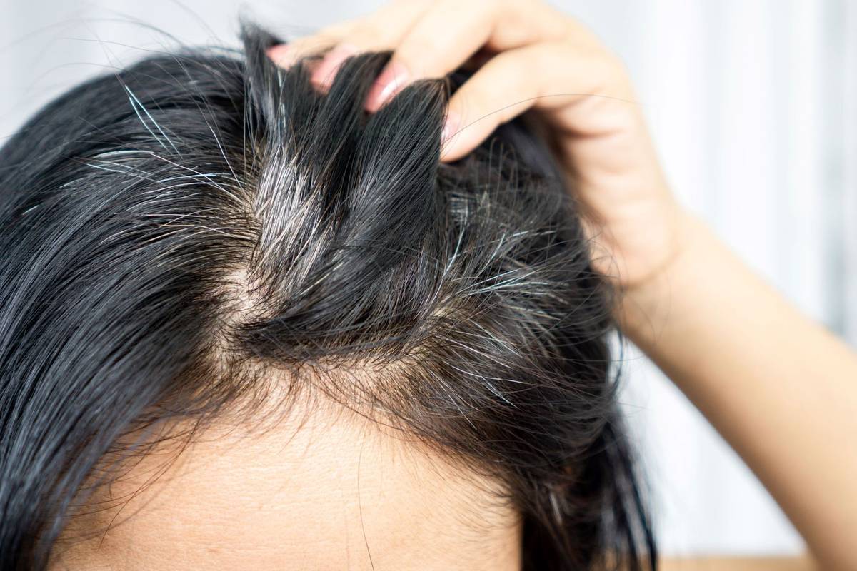 Why do young people go gray early? We explore the causes of premature graying: genetics, stress, diet, and more.