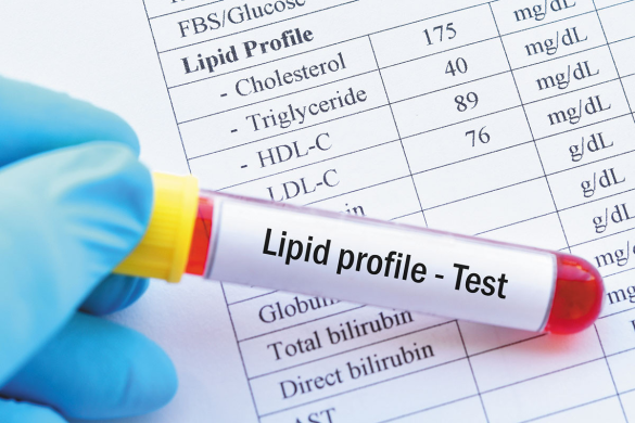 New cholesterol guidelines recommend one-time lipoprotein(a) testing, early statin therapy, and lifestyle changes to prevent heart disease in adults.