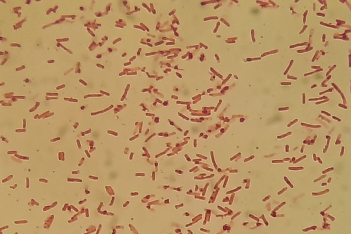 Shigella sonnei bacteria seen under a microscope after Gram staining